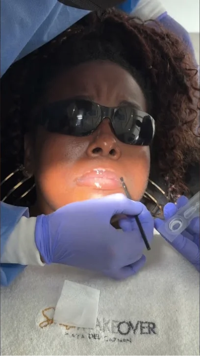Patient receiving professional care during a smile makeover procedure. Video review thumbnail highlighting top-tier cosmetic dentistry.