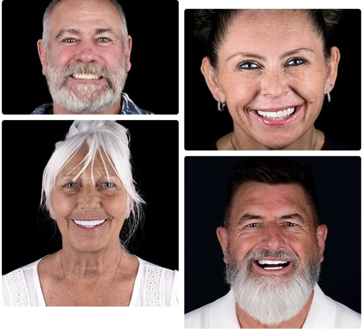 Custom dental bridge restoration alongside a titanium implant component used for replacing missing teeth.