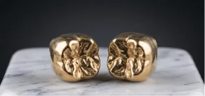 Custom-made gold dental crowns crafted for strength and durability.