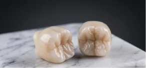 Premium zirconia dental crowns offering exceptional strength and aesthetics.