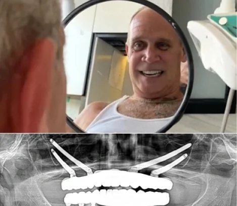 Patient reviewing final dental implant results during the completion stage of treatment.
