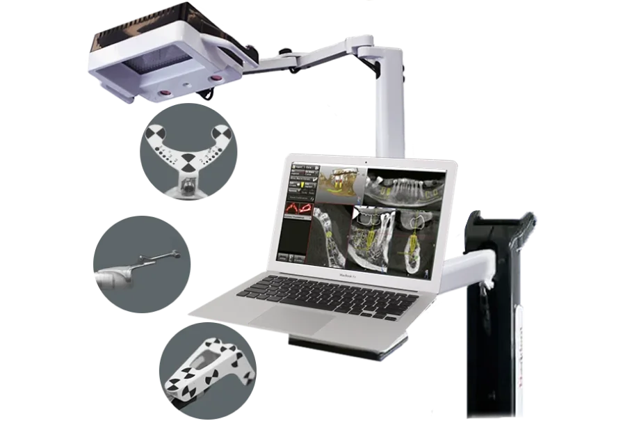 Advanced dental navigation technology used for precise implant planning and guided surgery procedures