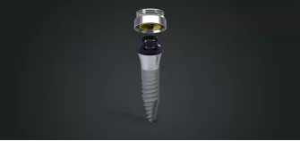 High-quality titanium dental implant with abutment designed for permanent tooth replacement.