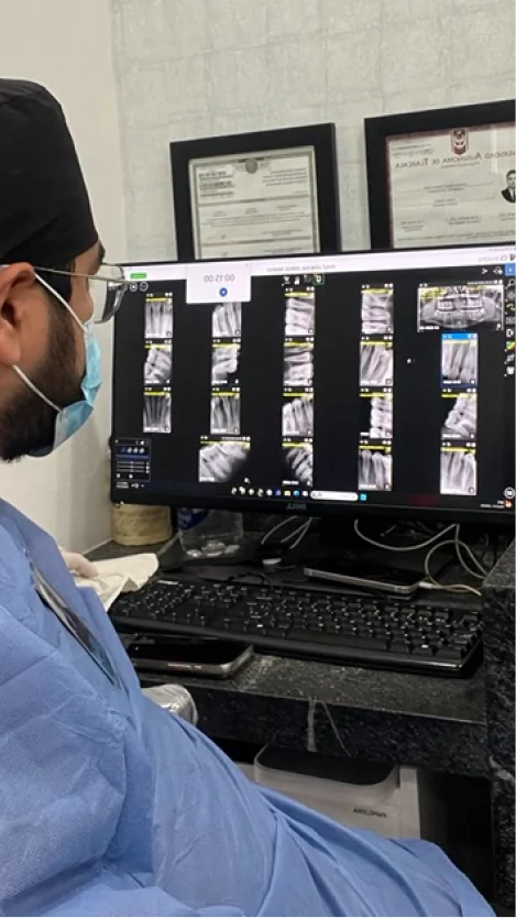 Dentist reviewing detailed digital dental X-rays to diagnose and plan a root canal treatment at SmileMakeover Playa del Carmen Dental.