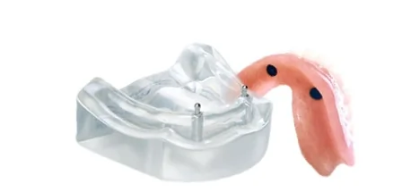 Ball abutment attachment system used to secure snap-on dentures to dental implants.