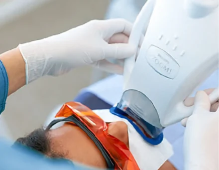 Close-up of a dentist performing a Zoom teeth whitening procedure, using the light-activation lamp on a patient wearing protective orange eyewear.