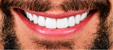 A close-up view of a man with a well-groomed beard, revealing a flawless, confident smile.